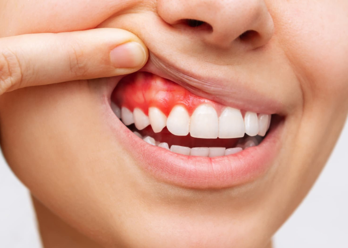 clinica-dental-poblesec-periodoncia